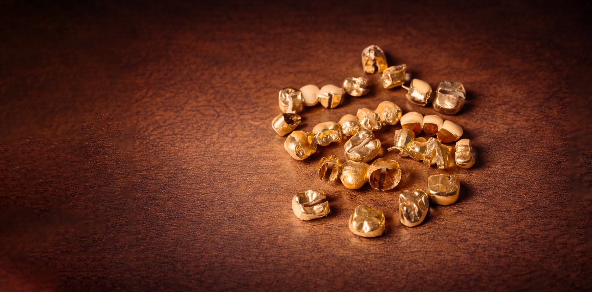 Vendre votre Or Dentaire à Paris - EPO GOLD Paris 16e